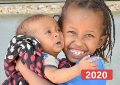 Atención primaria y reducción de la malnutrición infantil en clínica pediátrica en Etiopía