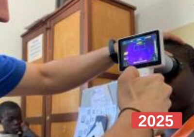 Campaña oftalmológica en Malawi y Uganda 2025